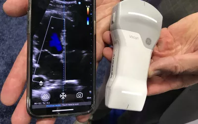The vScan Air point-of-care ultrasound (POCUS) system from GE Healthcare uses a wireless transducer that has two sides, offering probes for superficial vascular and deeper tissue imaging.  