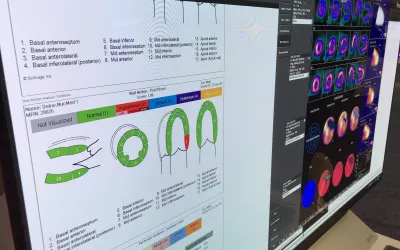 Multimodality reporting functionality for echo, nuclear and other imaging in a single cardiovascular information system (CVIS) on display at the ScImage booth at ACC22. #ACC2022