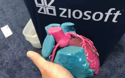 A 3D printed heart for educational and patient procedural planning and guidance on displays by the advanced visualization vendor Ziosoft.