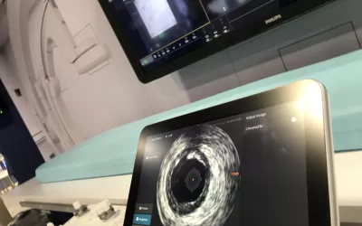 Integration of table side control for IVUS on Philips' Azurion angiography platform can help reduce carts in the cath lab and make it easier for the interventional operator. 