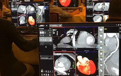 A sea of screens showing cardiac CTA post-processing assessments during a hands-on training session at SCCT.#SCCT #SCCT2022 #yesCCT #cardiacCT