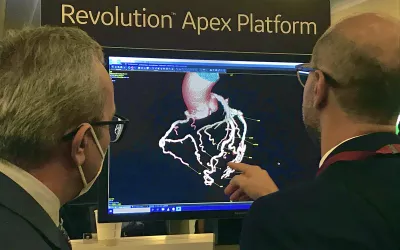 Post-processing of a cardiac CT dataset to extract a 3D view of a patient's coronary arteries. Part of a GE booth demo on the show floor. #SCCT #SCCT2022 #yesCCT #cardiacCT
