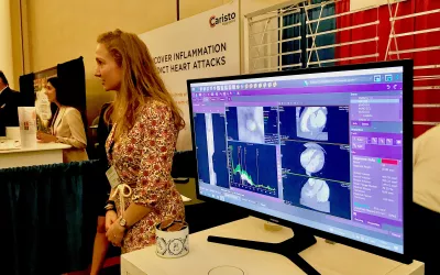 Automated coronary plaque assessment software displayed by Medis on the SCCT expo floor.  #CTA #CCTA #AI #SCCT #SCCT2022