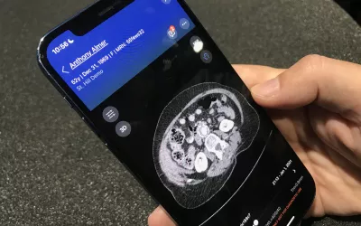 Example of an AI initiated acute care team alert for an abdominal aortic aneurysm (AAA) detection from a CT scan. The technology can speed diagnosis and treatment for these critical patients. Demo by Vis.AI at AHA 2022.