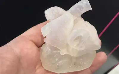 Example of a 3D-printed heart from the 3D printing vendor Ricoh at ACC.23. The company offers contract medical-grade 3D printing to hospitals that do not have a 3D print lab. The models are often used to help cardiologists better understand complex cases and to help guide procedures. #ACC