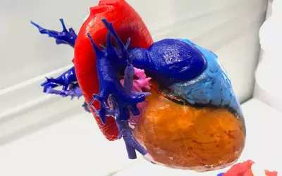 Example of a 3D-printed heart from the 3D printing vendor Ricoh at ACC.23. These models are often used to help cardiologists better understand complex cases and to help guide procedures. #3Dprint #3Dprintedheart #ACC23