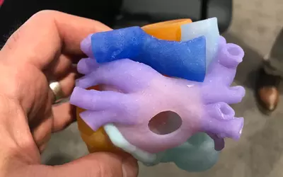 Example of the pulmonary veins on a 3D printed heart from the 3D printing vendor Ricoh at ACC.23. The models are often used to help cardiologists better understand complex cases and to help guide procedures.