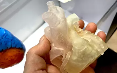 Example of a 3D-printed heart from the 3D printing vendor Ricoh at ACC.23. These models are often used to help cardiologists better understand complex cases and to help guide procedures. #ACC #3Dprinting