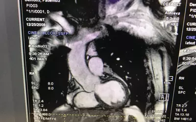Example of a cardiac MRI displayed in the syngo Dynamics CVIS.