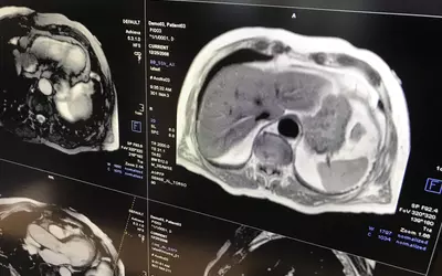 Example of a cardiac MRI displayed in the syngo Dynamics CVIS.