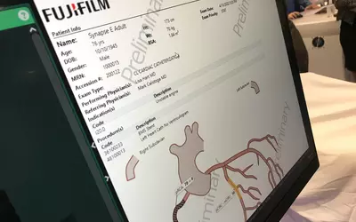 Example of a cardiology cath lab report with graphical display of the coronaries that can be modified and annotated. These changes translate text directly into the report to help the cardiologist save time. Example from the Fujifilm Synapse 7X CVIS system. #ACC23 #ACC