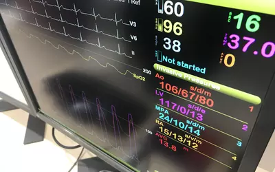 Example of a hemodynamic recording system for use in the cardiac cath lab. This is the Merative hemodynamic system on display at at ACC.23.
