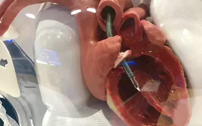 Model in the Abiomed booth showing placement of the Impella 5.5 liters per minute catheter heart pump. This is used for patients who need more support than a conventional Impella CP can offer, but does not require level of supported from ECMO.