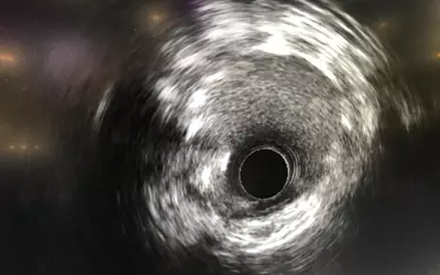 Example of intravascular ultrasound (IVUS) shown as part of the multimodality imaging capability on the Fujifilm CVIS.