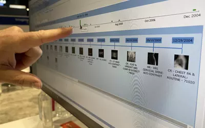 Enterprise Imaging PACS thumb nail images on a patient timeline shown by Agfa at HIMSS 2023. Photo by Dave Fornell