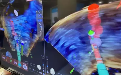 Biosense Webster NuVision Nav 3D 4D ICE integrated with Carto EP mapping system at HRS 2023. Photo by Dave Fornell