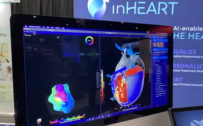 InHeart digital twin software based on real patient data displayed at HRS 2023 to allow virtual ablations and lead placements to better preplan EP procedures. Photo by Dave Fornell 