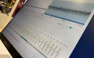 Philips Cardiologs remote monitoring automated ECG analysis demonstration at HRS 2023. Photo by Dave Fornell