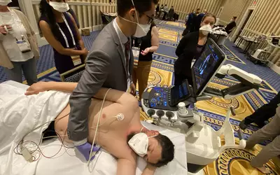 Patient cardiac ultrasound during a strain echo sonograptraining session at ASE 2023.