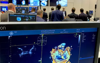3D/4D TEE imaging of the mitral valve during a training session for how to implant a MitraClip at TCT 2023. Photo by Dave Fornell
