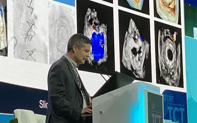 Cephea TMVR trial data explained by Juan Granada at TCT 2023. Photo by Dave Fornell