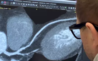 Coronary CCTA cardiac CT training for interventional cardiologists, GE session at TCT 2023. Photo by Dave Fornell