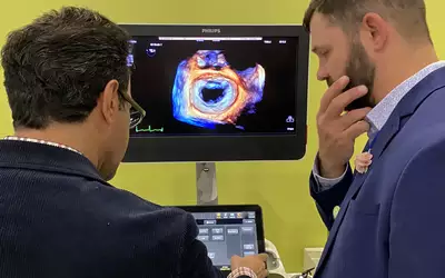 Mitral valve on 3D/4D echocardiography demonstrated on the Philips Epiq system. Photo by Dave Fornell