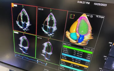 Siemens Healthineers recently unveiled its Acuson Origin, a new cardiovascular ultrasound system with robust artificial intelligence (AI). The AI capabilities allow it to identify the anatomy being imaged and anticipate the next steps needed to complete the imaging exam. This includes AI algorithms to automate approximately 500 different measurements.
