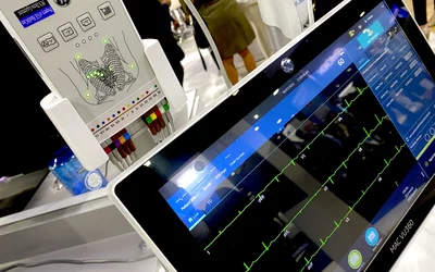 Example of a 12-lead ECG, EKG, the GE MAC VU360 system at ACC.24. The 12-lead GE MAC VU360 ECG system with automated lead detection displayed on the expo floor.
