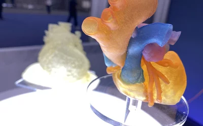 3D printed hearts in the Ricoh booth at ACC.24. These are printed from CT scans from patients and can be used to help plan and guide procedures, for patient education and medical student training.
