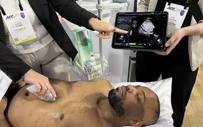 AI guided echo exam using Caption Health integrated with GE Vscan MW ACC24. Photo by Michael Walter