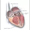 interventional cardiology heart failure cleveland clinic 