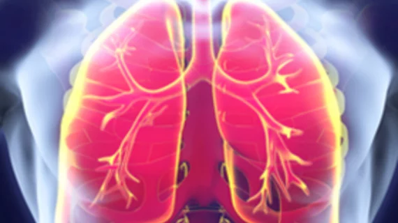 lungs_12116.jpg