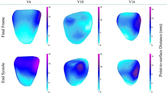 Cardiac MRI