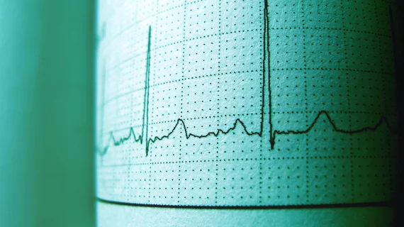 Electrocardiograms analyzed by AI can offer information about mortality risk.