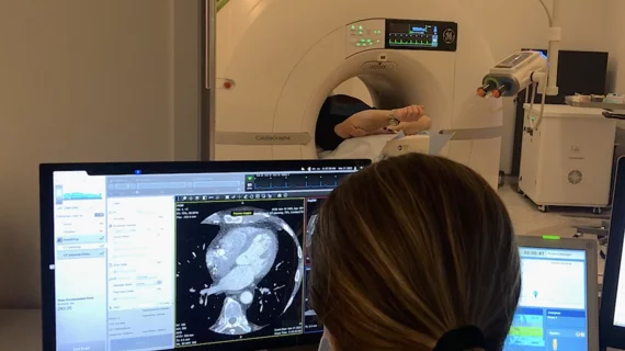 Cardiac CT scan for a pre-procedural assessment of a left atrial appendage occlusion (LAAO) procedure at Duly Healthcare in the Chicago suburbs. Cardiac CT use has increased the past few years and now CMS is looking to double what it pays for them in the 2025 HOPPS proposed rule. Photo by Dave Fornell