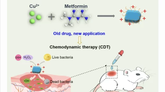 metformin chemodynamic therapy type 2 diabetes Nano Research