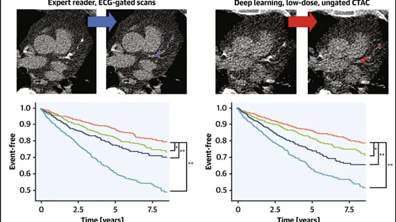 A study published this week in the Journal of the American College of Cardiology (JACC): Cardiovascular Imaging shows artificial intelligence (AI) algorithms can more rapidly and objectively determine calcium scores in computed tomographic (CT) and positron emission tomographic (PET) images than physicians.[1] The AI also performed well when the images were obtained from very-low-radiation CT attenuation scans. https://doi.org/10.1016/j.jcmg.2022.06.006