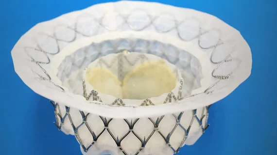 The Medtronic Intrepid transcatheter mitral valve replacement (TMVR) system performed well in two studies presendted at TCT 2022. #TCT #TCT22 #TCT2022 #TMVR