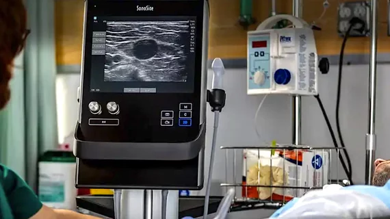 Use of ultrasound to guide needles used for femoral vascular access for cath lab procedures can help reduce bleeding and vascular complications. But the Universal Trial at TCT 2022 showed no difference. Image courtesy of Sonosite
