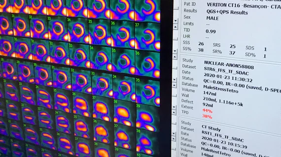Cardiac SPECT nuclear imaging myocardial perfusion_Spectrum Dynamics_RSNA22_DF_3.jpeg