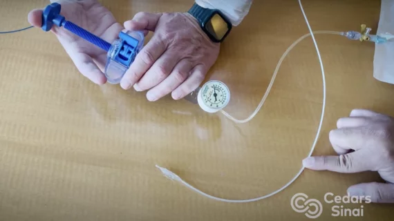 The Minima Stent being demonstrated by Cedars Sinai Hospital. The adjustable stent is designed to grow with children who need cardiac procedures. 