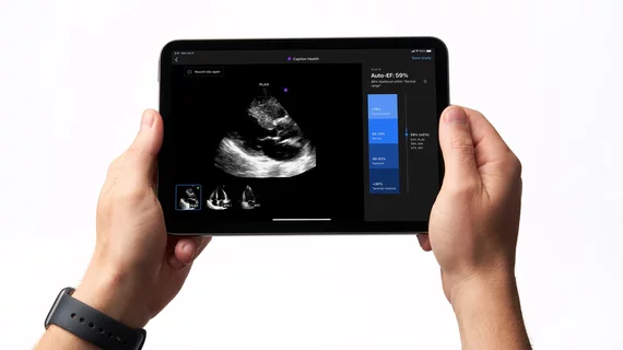 GE healthcare has purchased Caption Health. This added cardiac ultrasound AI guidenance to GE's echocardiogram systems so even inexperienced sonographers and point of care ultrasound (POCUS) users will be able to obtain high-quality echo exams.