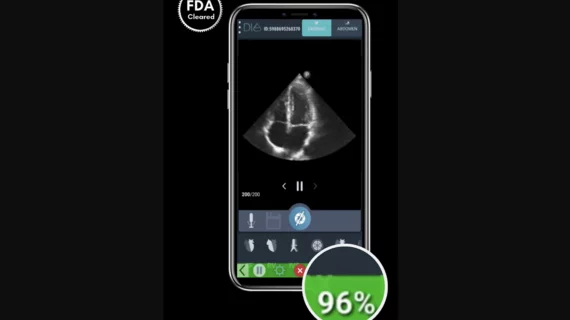 DiA Imaging Analysis, an Israel-based healthcare technology company, has gained U.S. Food and Drug Administration (FDA) clearance for LVivo IQS, a new software solution designed to help users acquire high-quality echocardiography images.