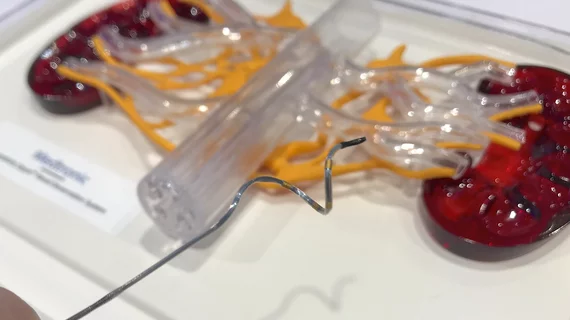The Medtronic Symplicity Spyral renal denervation catheter with a simulator model at the ACC 2023 meeting. Photo by Dave Fornell