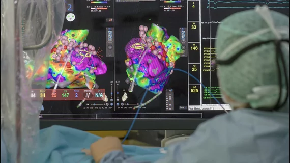 EP lab Carto mapping system ablation procedure. Biosense Webster image from German Heart Centre Munich