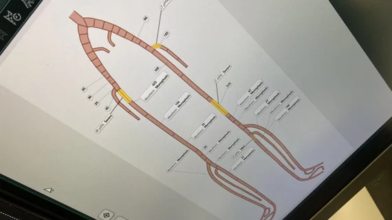 PAD peripheral femoral and illiac artery diagram for CVIS interventional reporting Fujifilm HIMS23_DF