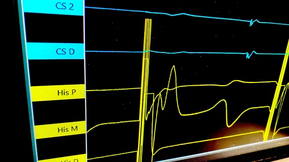 CathVision ECGenius high fidelity EP recording system showing His bundle pacing demo at HRS 2023. Photo by Dave Fornell