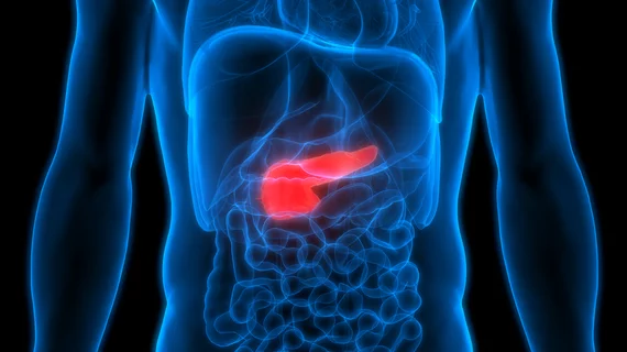 The FDA has approved donislecel, a new pancreatic islet cellular therapy made from the pancreatic cells of deceased donors, for the treatment of type 1 diabetes among adult patients with severe hypoglycemia. Lantidra