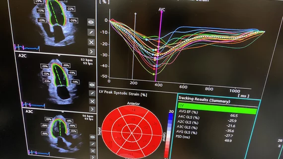 Example of the Siemens Origin AI-automated cardiac ultrasound system performing auto contours and measurements after the AI sees what is being imaged and the operator hits the AI button on the console. The system is designed to be an assistant to the operator and knows the next steps in the exams.